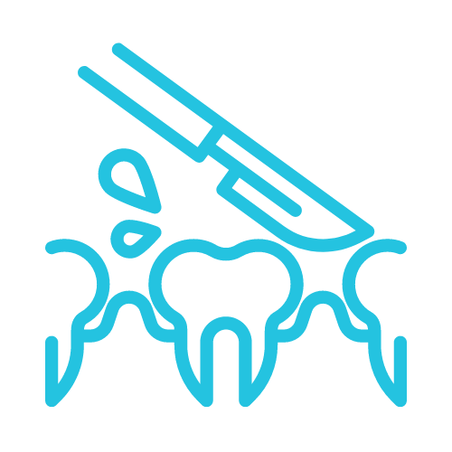 (5) Periodontal Flap Srgery icon 2024 (5) Periodontal Flap Srgery icon 2024